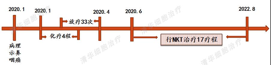 鼻咽癌放疗25次的报告,鼻咽癌化疗两次放疗33次严重吗