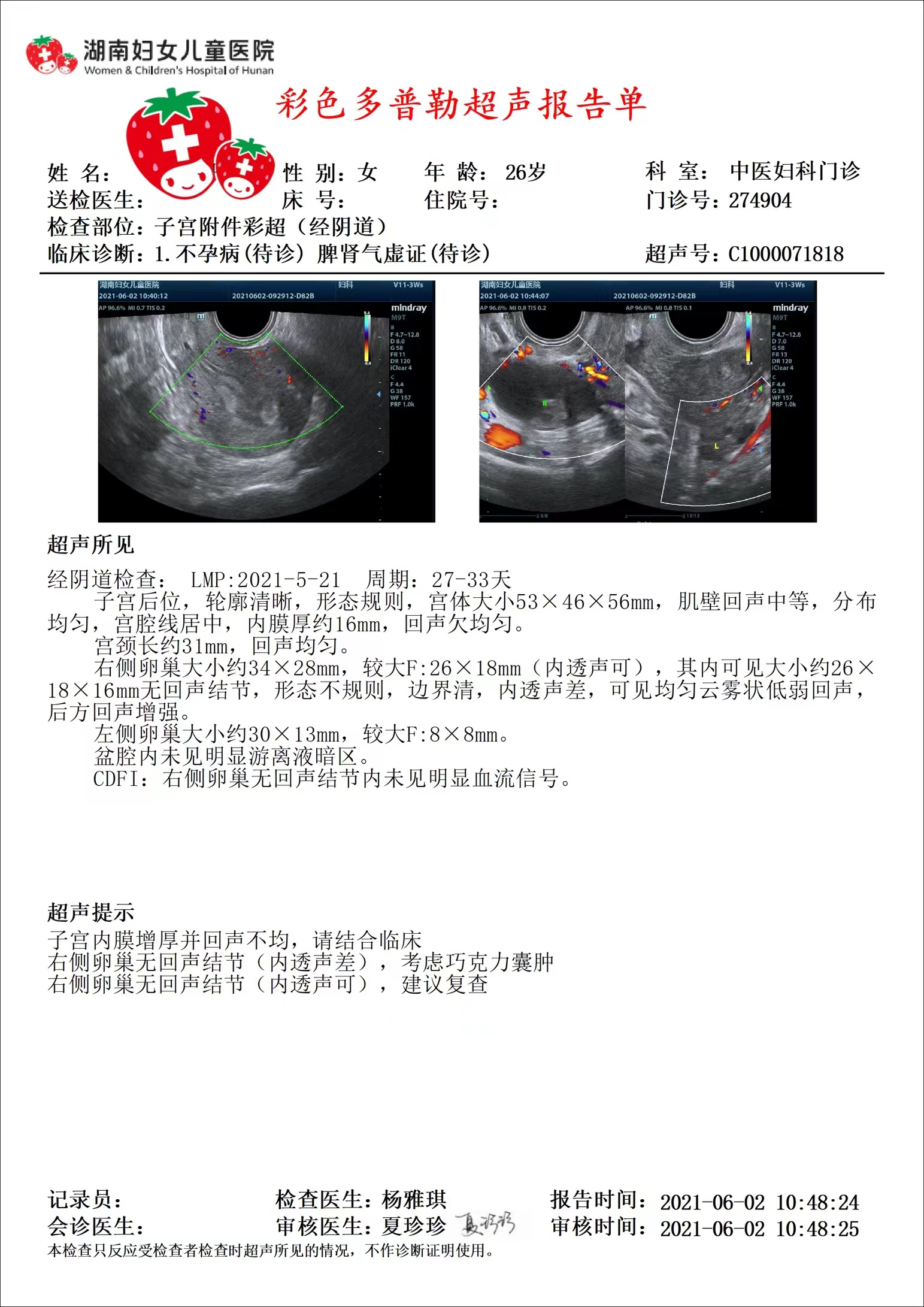 卵巢巧克力囊肿会导致不孕么,每月月经痛怎么调理