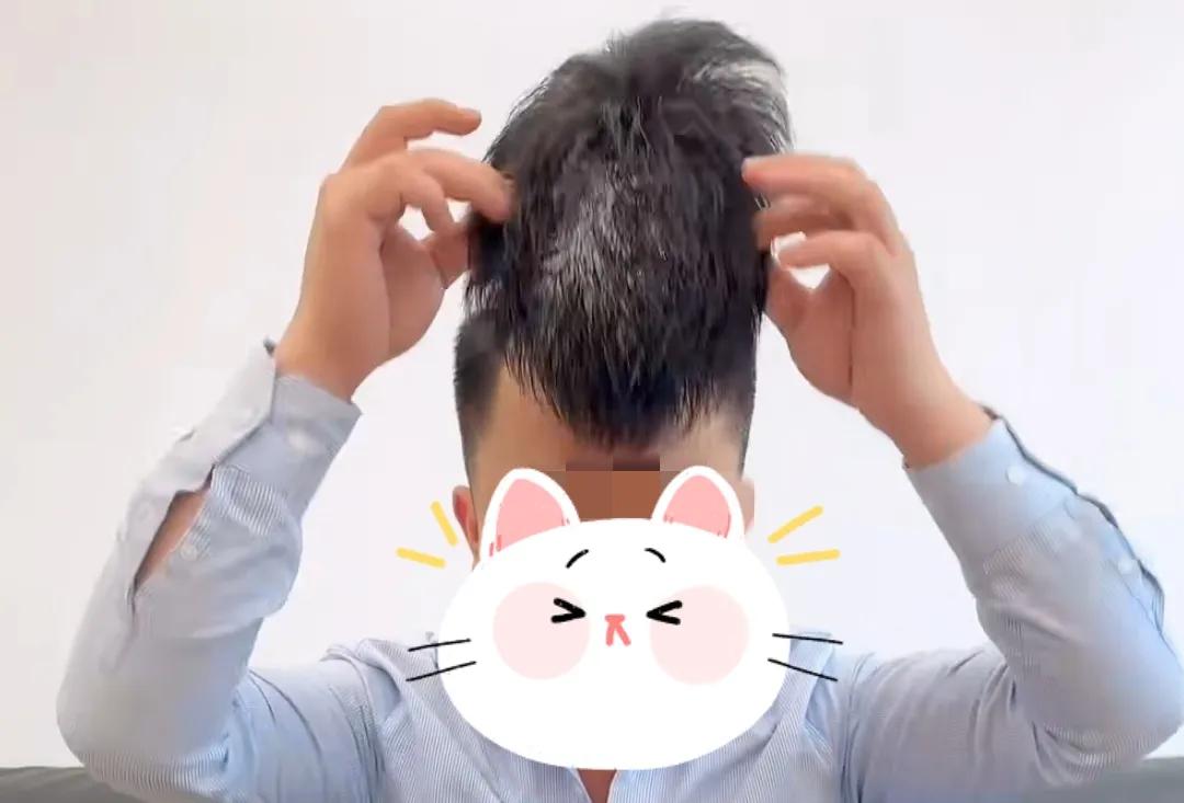 白头发不染可以戴假发吗,假发可以解决白头发的烦恼