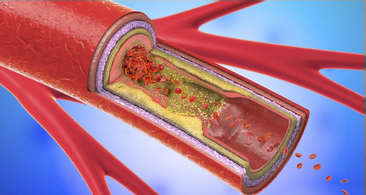 香烟为什么要分硬和软,香烟为什么要分硬盒和软盒