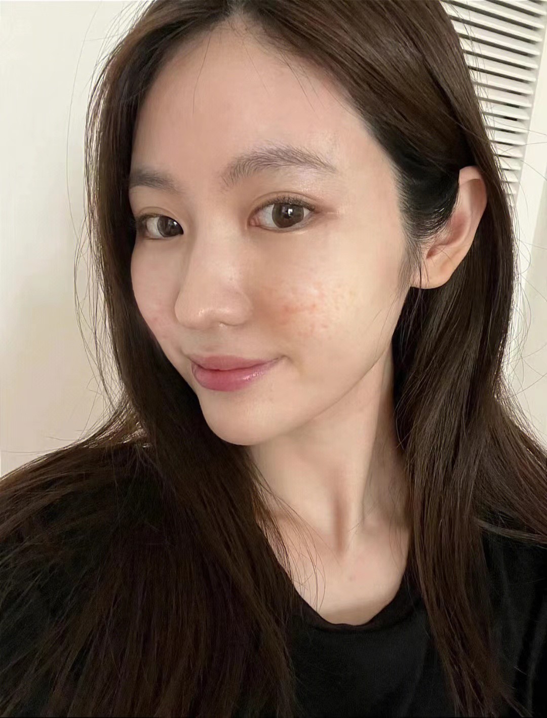 脸上长痘痘坑快速消除,脸上长痘怎么祛痘印痘坑