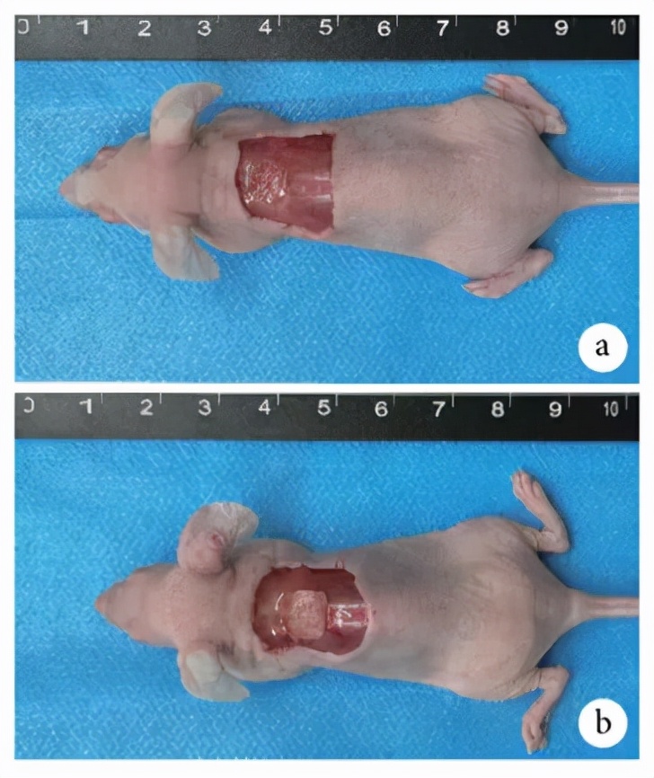 干细胞再造术,干细胞可以治疗不孕不育症吗