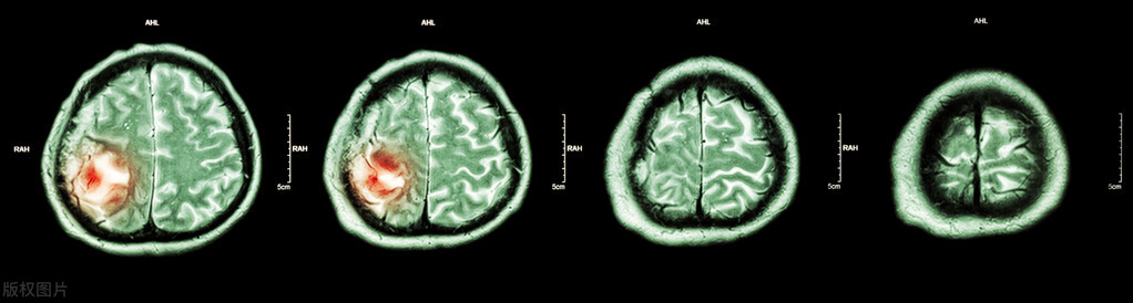 网上买的书为何气味重,书有刺鼻味是什么原因