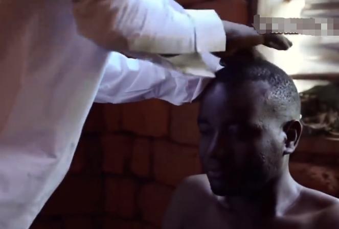 非洲医疗有多恐怖？小伙患上前列腺，医生竟用锤子砸胸口祛除病魔