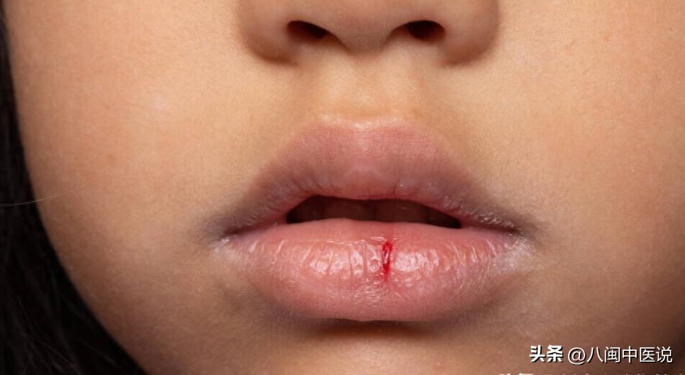 脾胃虚弱怎么办嘴干嘴裂,嘴巴干是脾胃问题吗