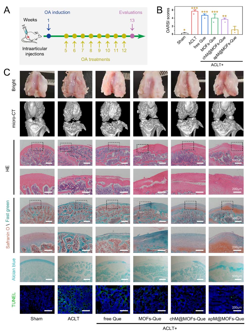 骨关节炎诊治要点及研究进展,骨性关节炎最新研究成果
