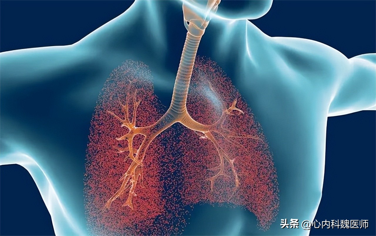 盐酸氨溴索口服溶液治疗肺炎,盐酸氨溴索片对支原体肺炎有效吗