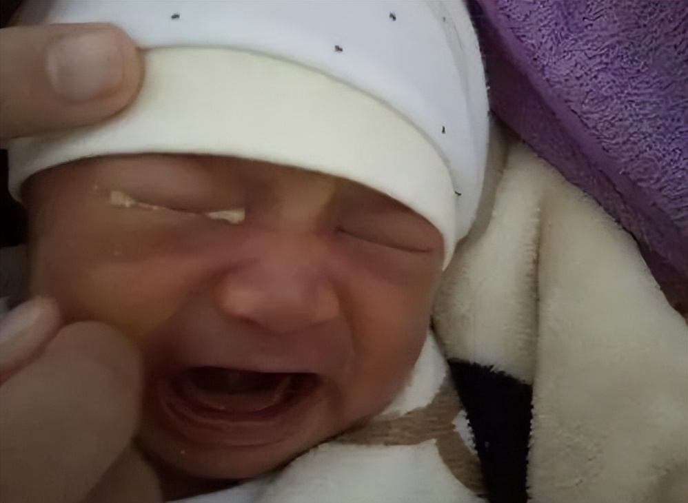 怎么确定宝宝胸部发育了,新生儿乳腺发育