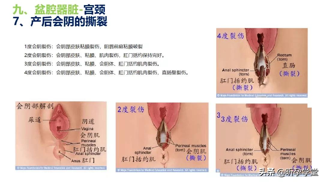 盆底肌修复紧致瑜伽,盆底肌修复瑜伽私教