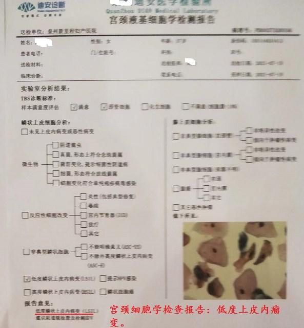 治疗hpv高危持续感染的临床研究,治疗hpv高危感染的科普文章