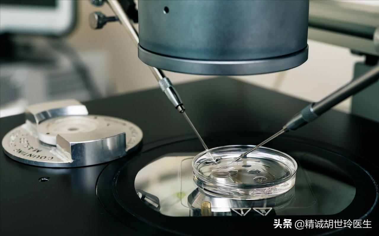 试管婴儿促排卵期间的注意事项,试管婴儿术前检查流程步骤