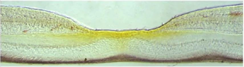叶黄素我们真的需要吗,爱护叶黄素