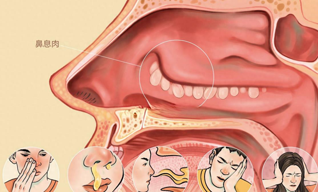 痛苦的手术排名,十大最痛苦的手术排名