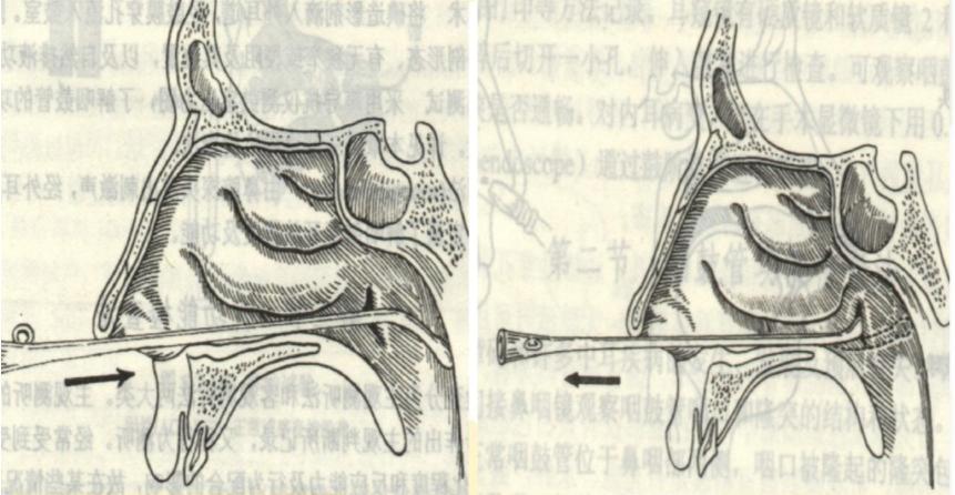 爱耳小知识,爱耳日科普