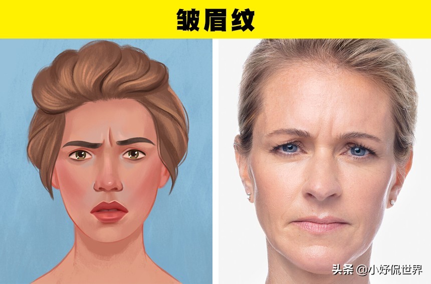 脸上有3种皱纹可能是健康的预警,皱纹跟情绪有关系吗