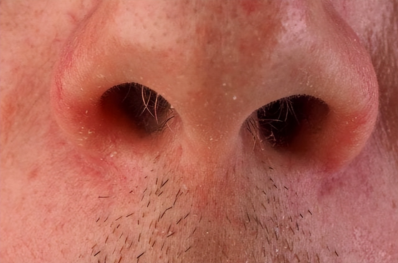 鼻毛为什么会变白医生告诉你答案,男性头发胡子鼻毛变白是什么原因