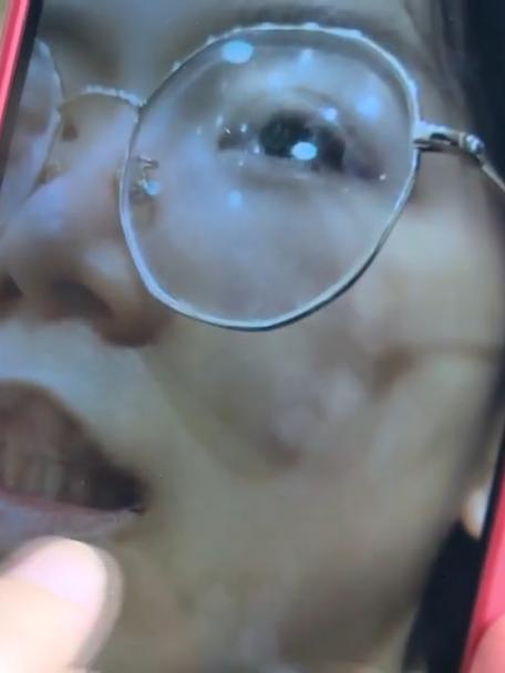 怀孕七个月有时被孩子打没事吧,孕四个月被棍子打到肚子上