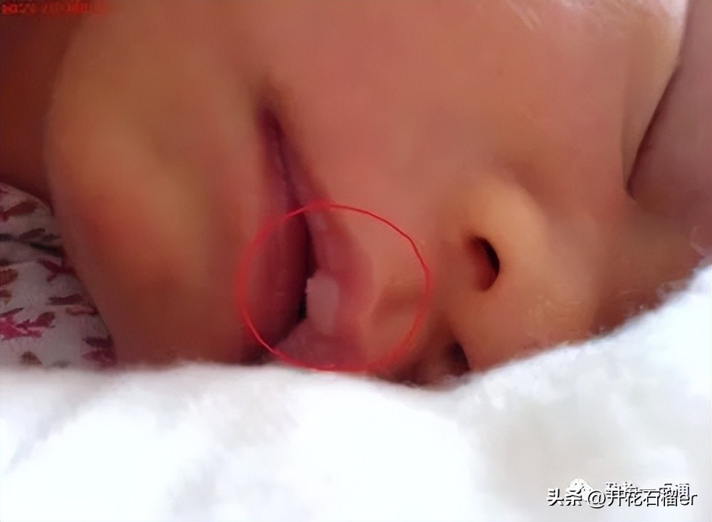 新生儿这5大状况你最担心哪个,新生儿有些表现不用治您知道吗