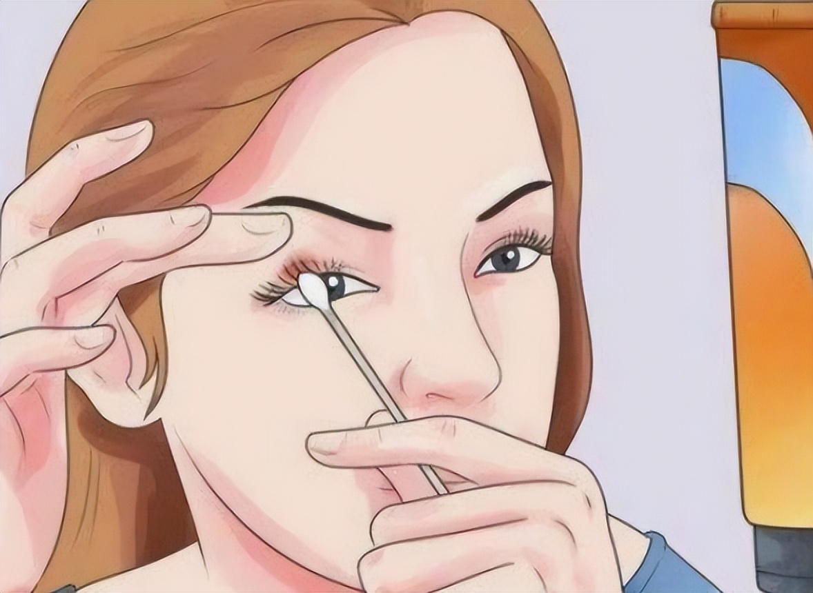 用红霉素软膏皮肤会变黑吗,用红霉素软膏擦一擦就好了