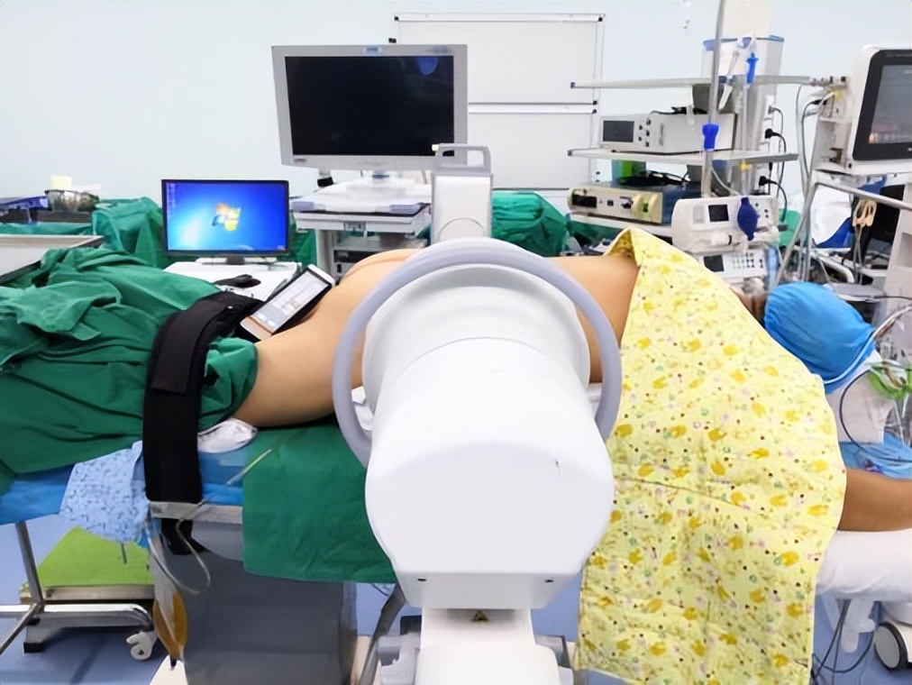 干货|一文掌握Endo-TLIF技术操作要点