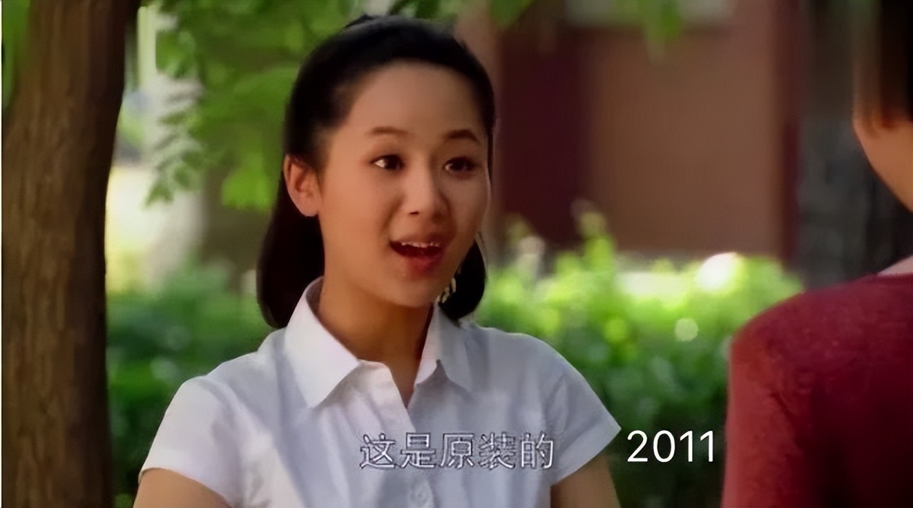 最近脸僵硬的女星,脸部变僵硬的女明星