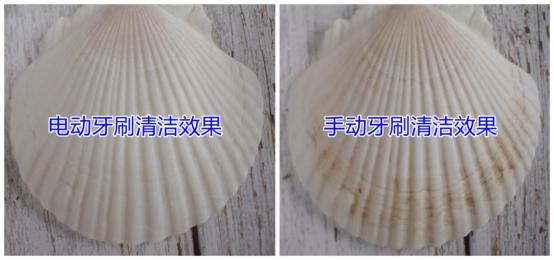 小米声波电动牙刷伤牙齿吗,什么电动牙刷好用又不伤牙齿