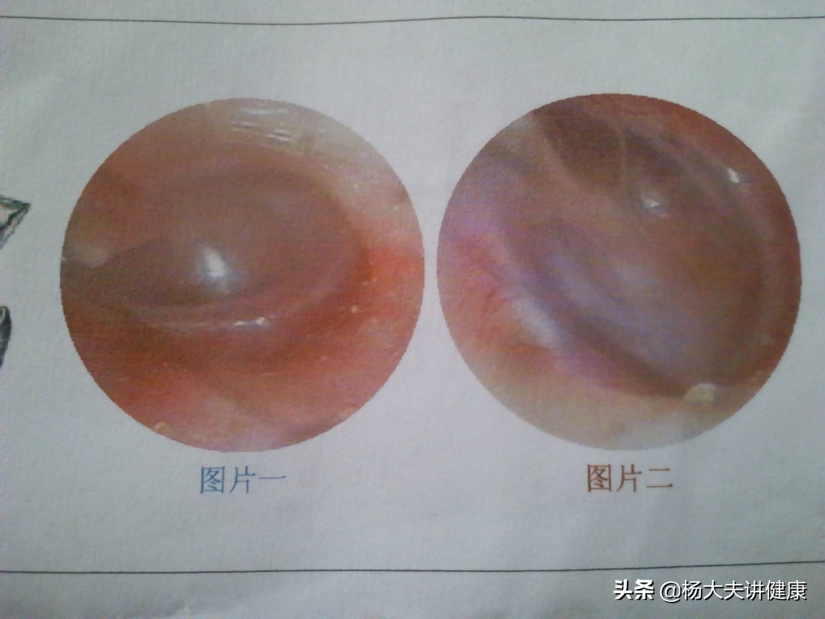 12岁男童服用阿奇霉素后死亡后续,10岁男孩用阿奇霉素后死亡