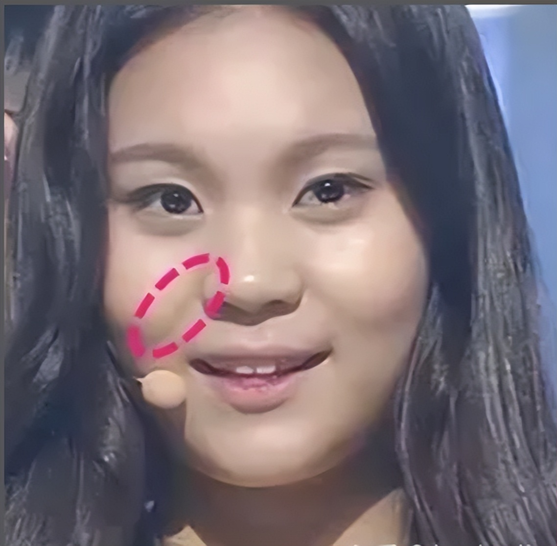 45岁的娃娃脸显老还是显年轻,娃娃脸为什么显年轻