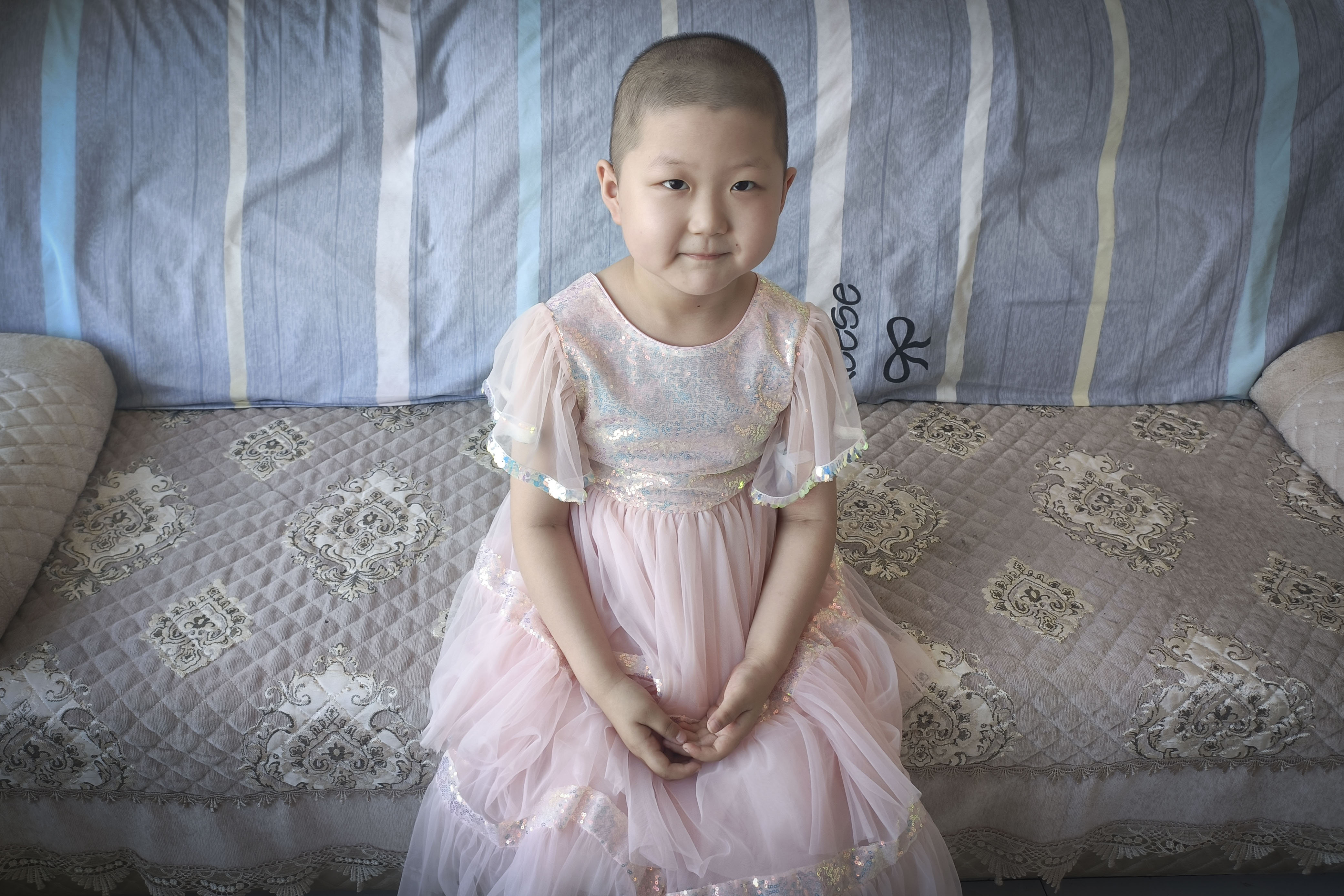 六岁小孩手指起水泡一碰很疼,五岁女童手指有严重倒刺