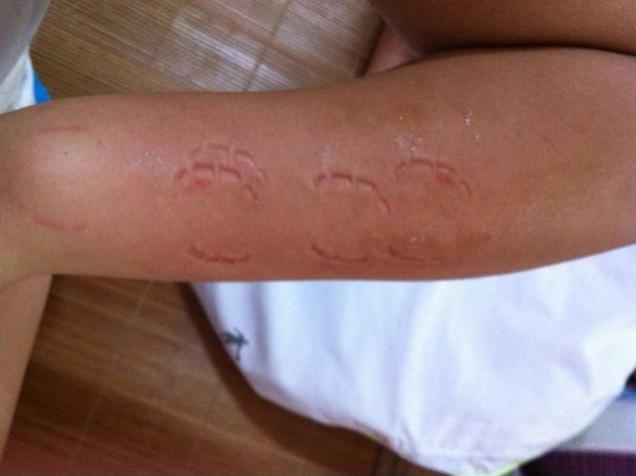 宝宝爱咬人爱抓人怎么办,宝宝喜欢咬人打人怎么纠正