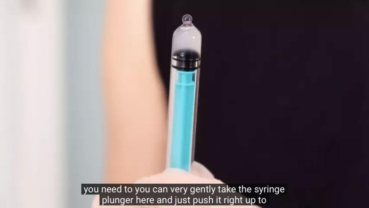 人工授精专用针管,英国妇女试管婴儿