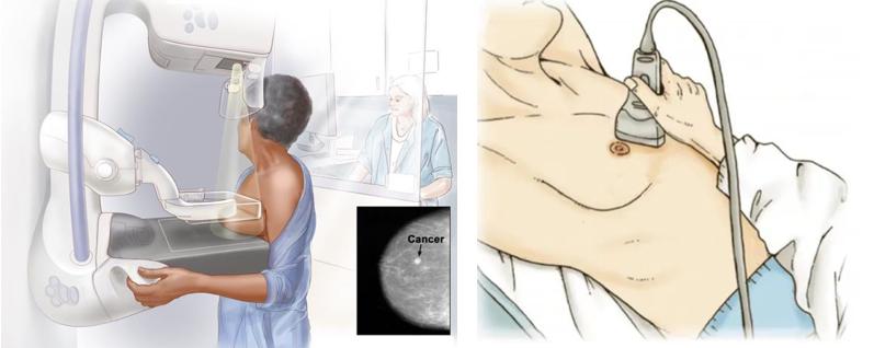 体检医生的陷阱,医生检查项目骗局