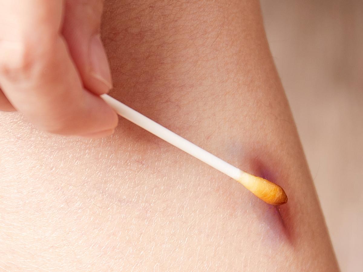 妻子和丈夫同房，被丈夫“种草莓”，第二天匆匆赶到医院，为何？