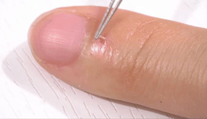 手指长倒刺缺乏哪种维生素,宝宝手指倒刺是缺什么维生素