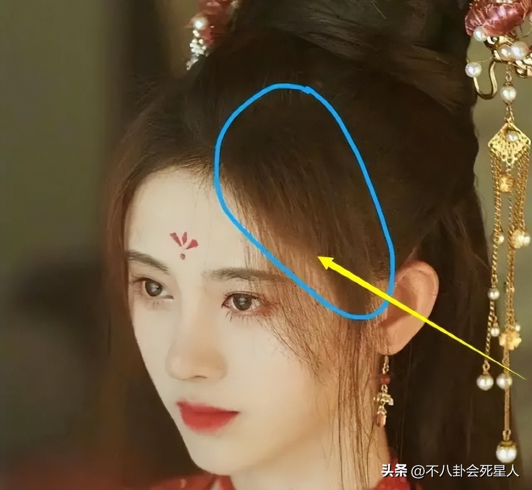 假双眼皮的明星,明星的假脸