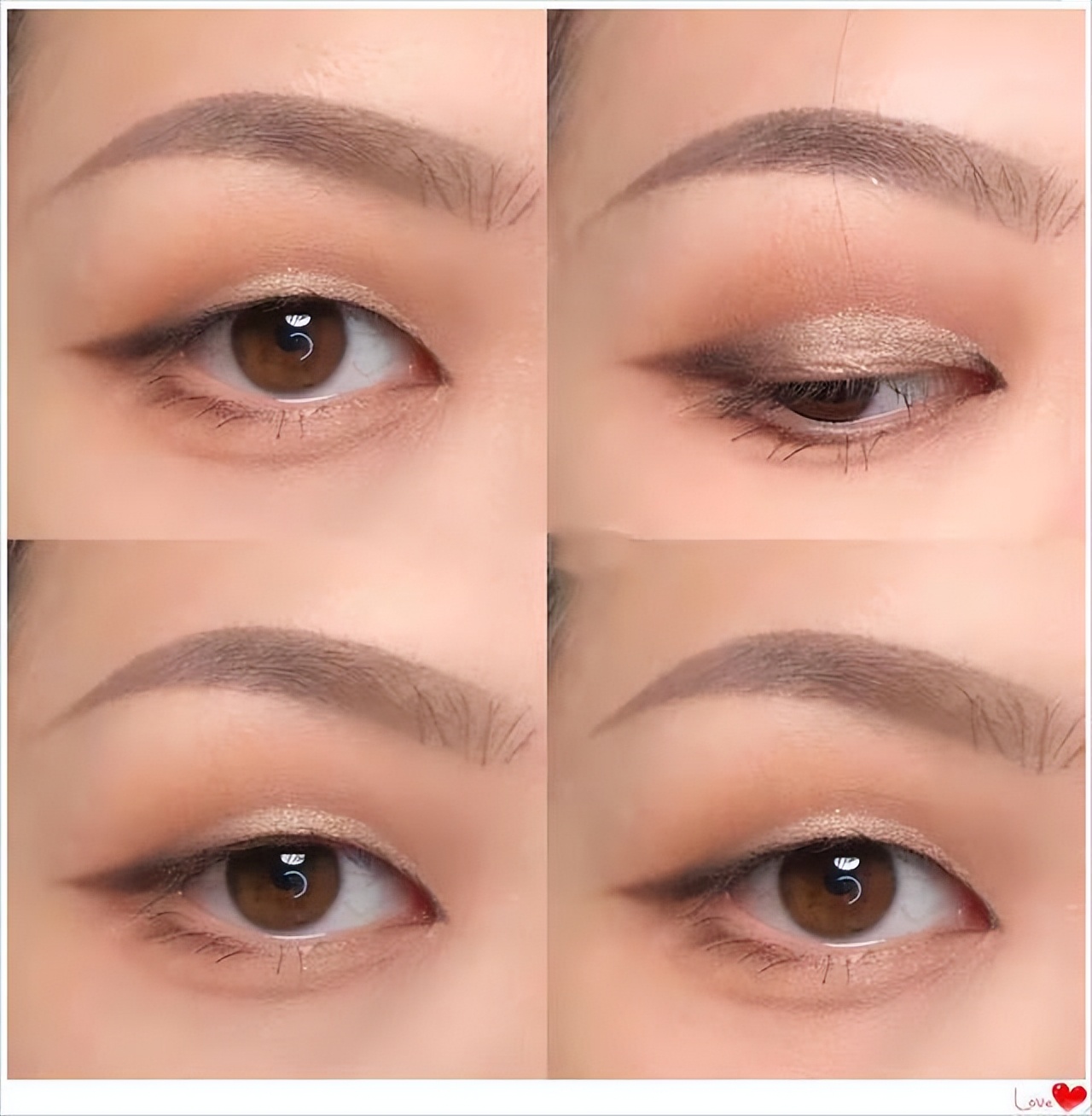 双眼皮手术后1-3天最尴尬的事,全切双眼皮出现大小眼是什么原因