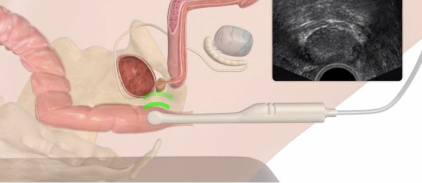超声检查注意事项动画,超声检查注意事项