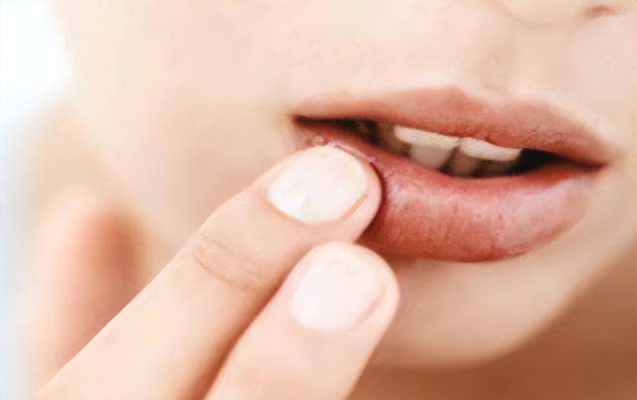 红霉素软膏涂眼睛后果,红霉素软膏眼白处可以涂吗