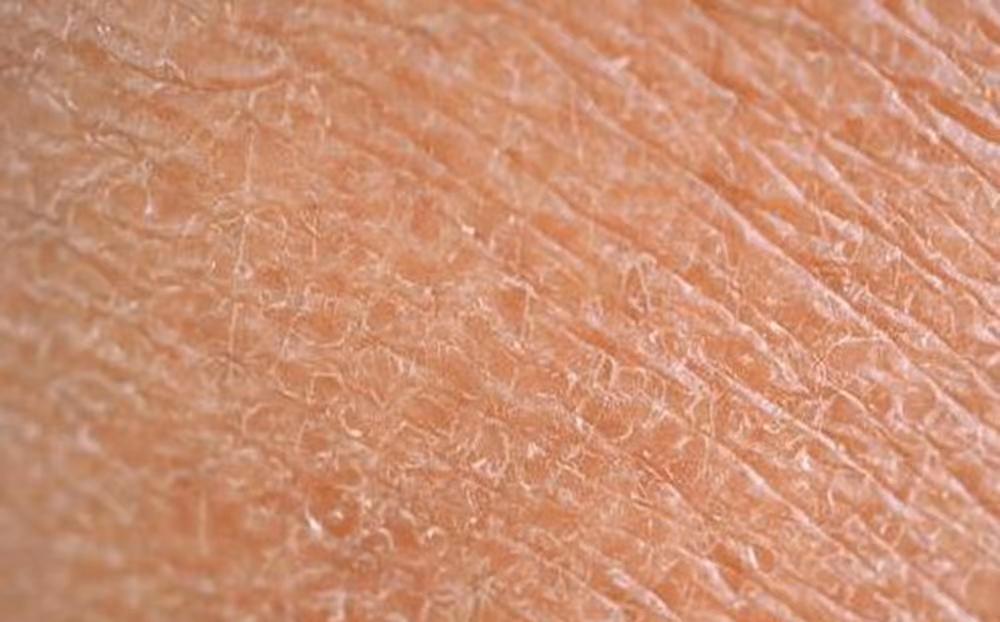 入秋皮肤痒起包怎么办,地肤子白鲜皮治皮肤瘙痒有绝招