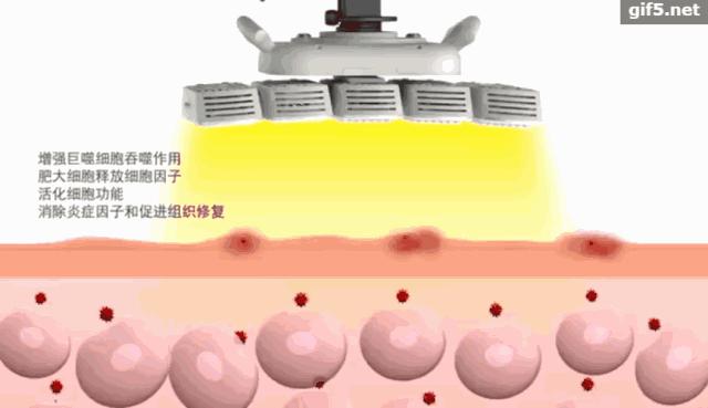 肌肤敏感发红发烫,肌肤敏感泛红怎么办