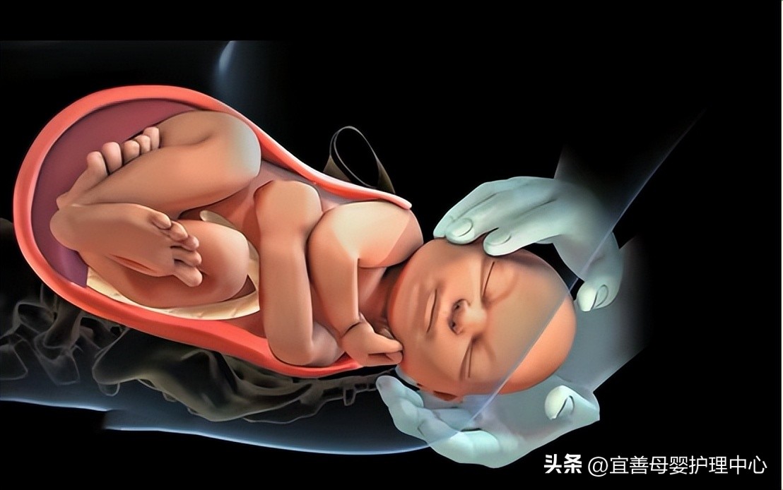 顺产妙招,顺产小妙招