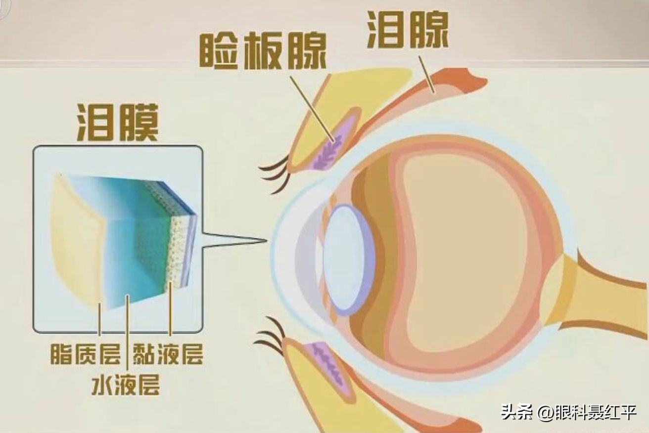 老年人干眼症的危害,激光术后干眼症危害