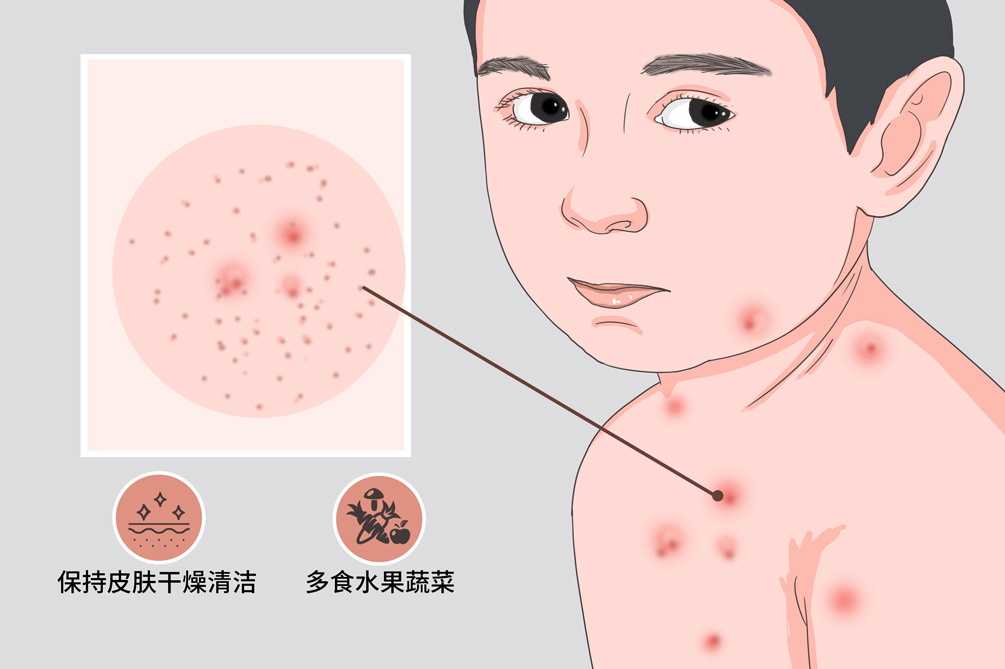 人类全身褪去毛发后,为什么只留下头发、阴毛和腋毛?