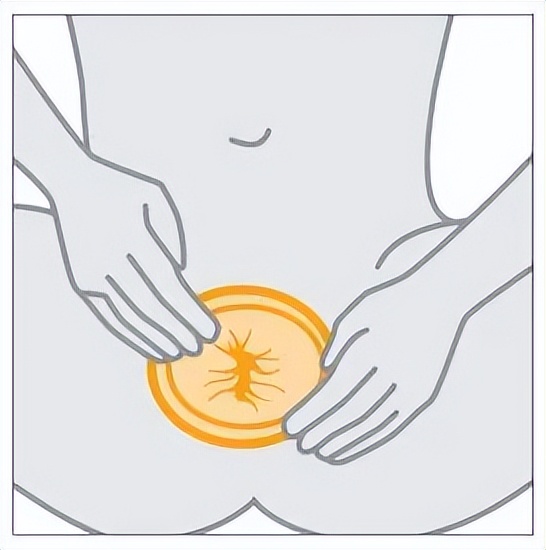 套套只能男人用？