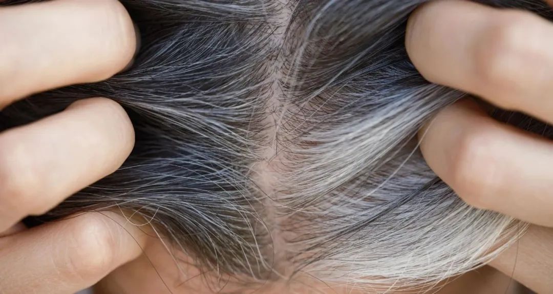 科学研究的最新发现白发变黑发,头发白发转黑真实亲身体验