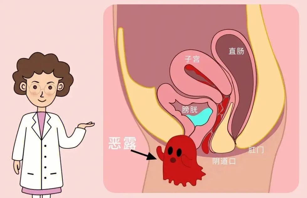 阴道长期流血是什么原因,阴道不规则流血是什么原因