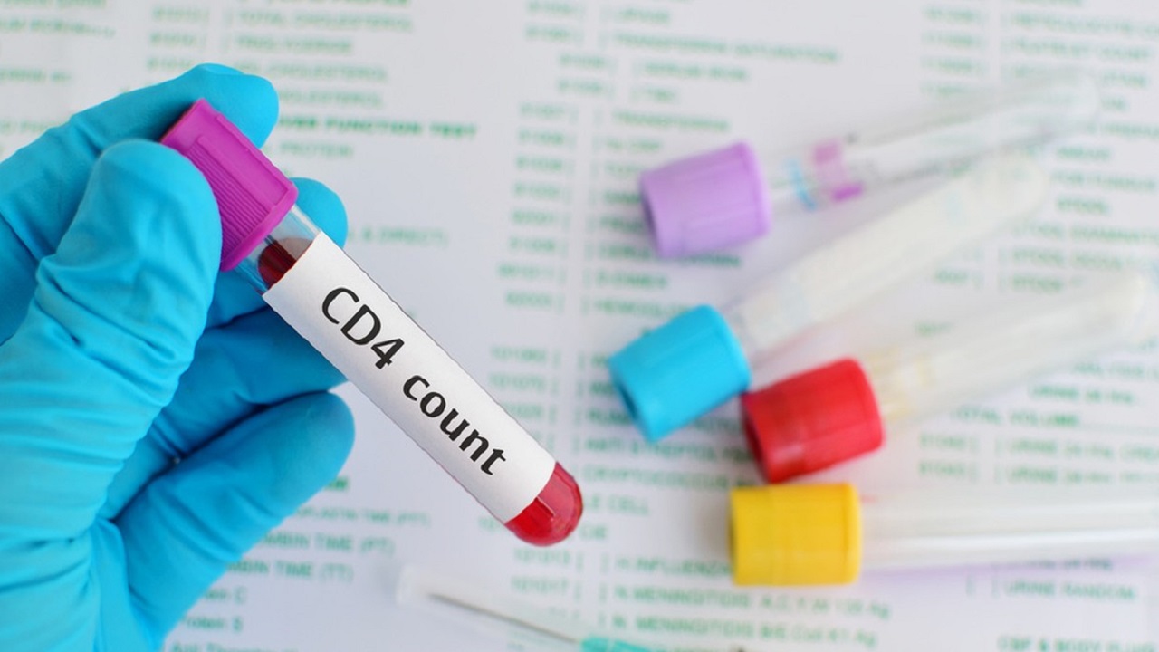 男子持续低烧查出艾滋,高烧不退男生