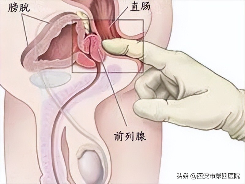 健康科普预防癌症,如何有效的预防癌症遗传