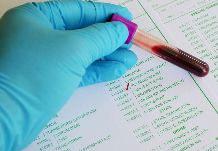 血常规中嗜酸性粒细胞升高要警惕,血热做血常规什么指标会升高