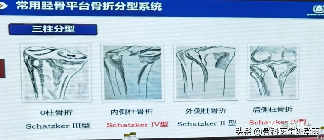 国家卫健委主办的骨创伤专项能力培训项目----下肢损伤学习班